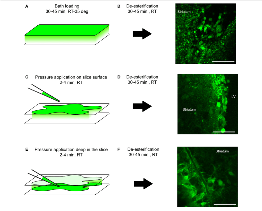 Loading Protocol Of Calcium Indicator Dyes - Brain Slice Calcium Imaging Clipart (850x685), Png Download