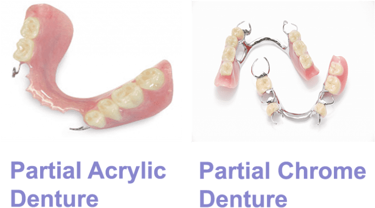 What Are Immediate Dentures - Homenature Clipart (768x473), Png Download