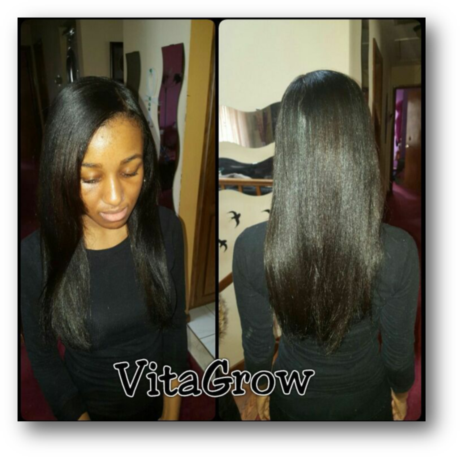 Nutraburst Hair Growth - Lace Wig Clipart (1625x1610), Png Download