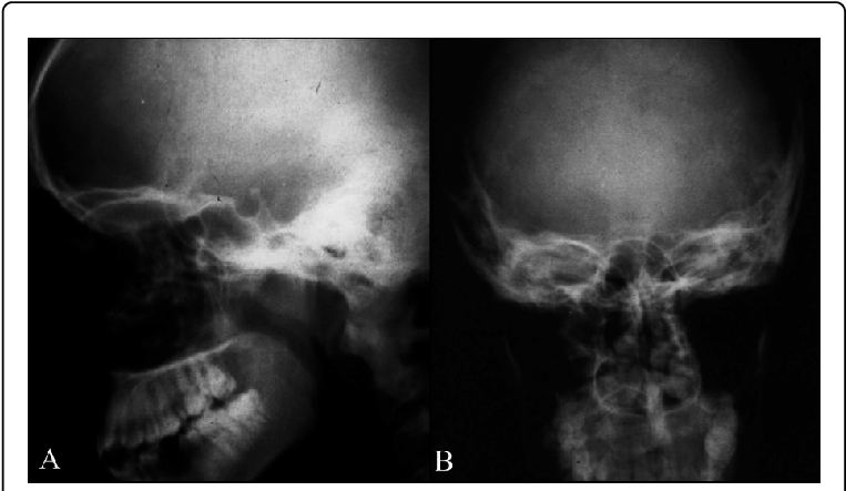 Lateral And Forward (b) Radiographs Post-surgical - Radiology Clipart (769x446), Png Download