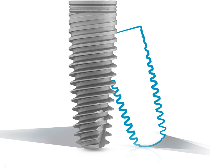 Learn More - Mis C1 Implant Clipart (699x556), Png Download