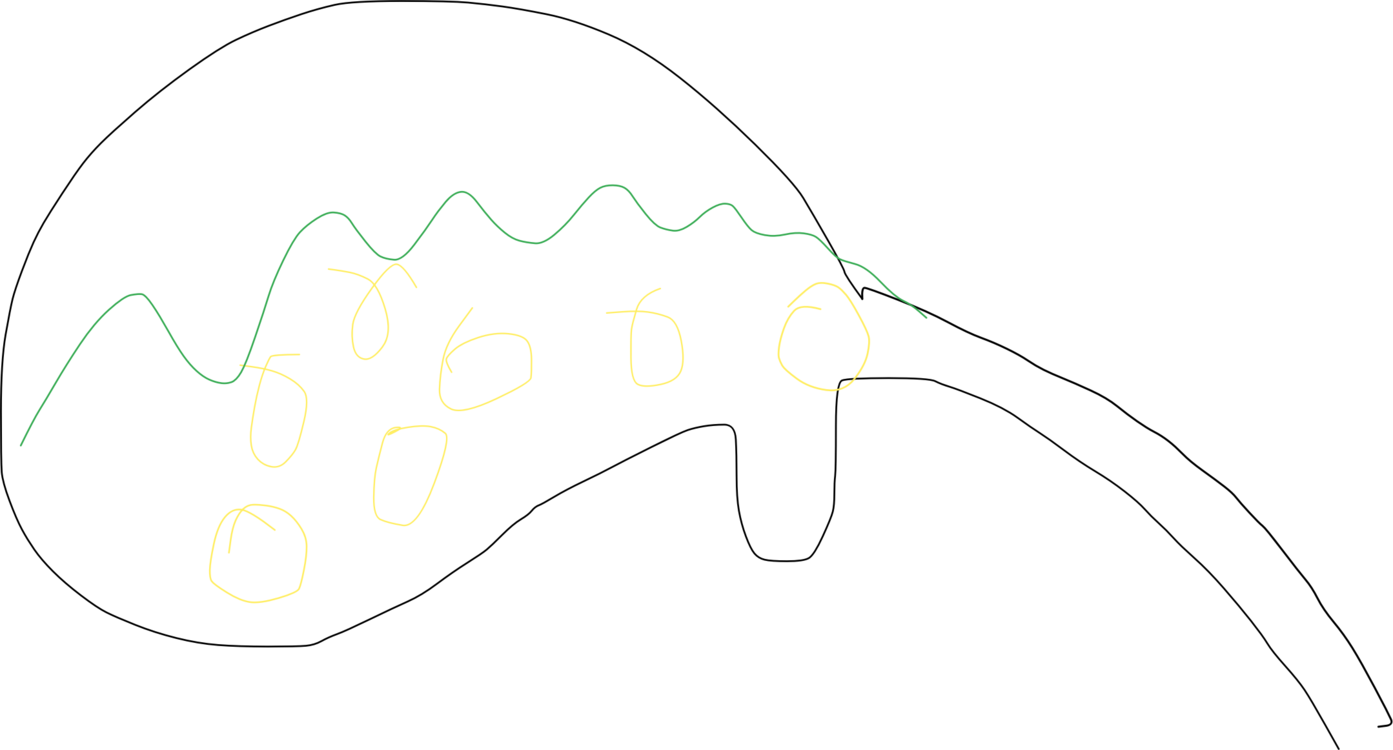 Finger Clipart In Ear - Drawing - Png Download (1393x750), Png Download