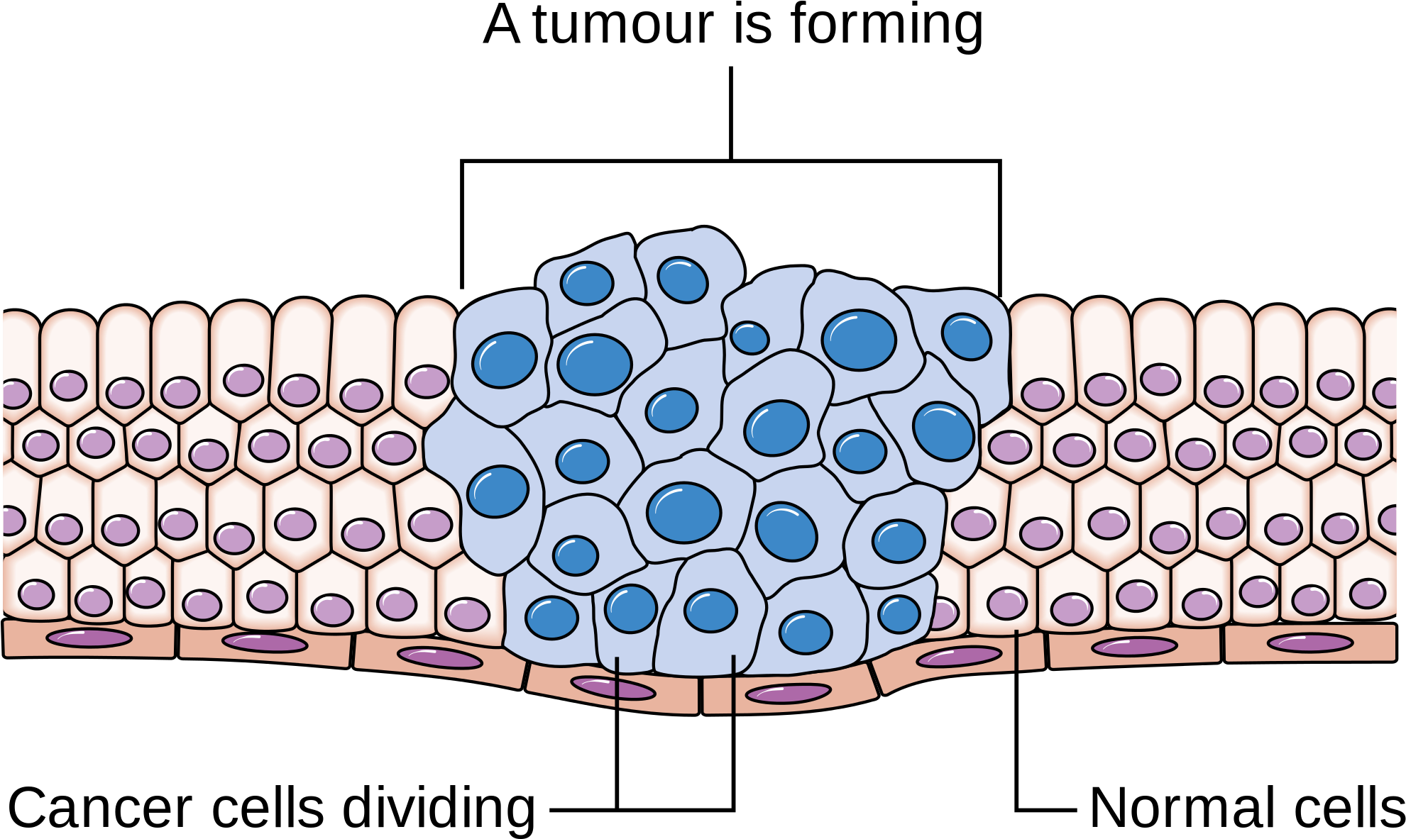 Mitosis Cancer Clipart (2000x1608), Png Download