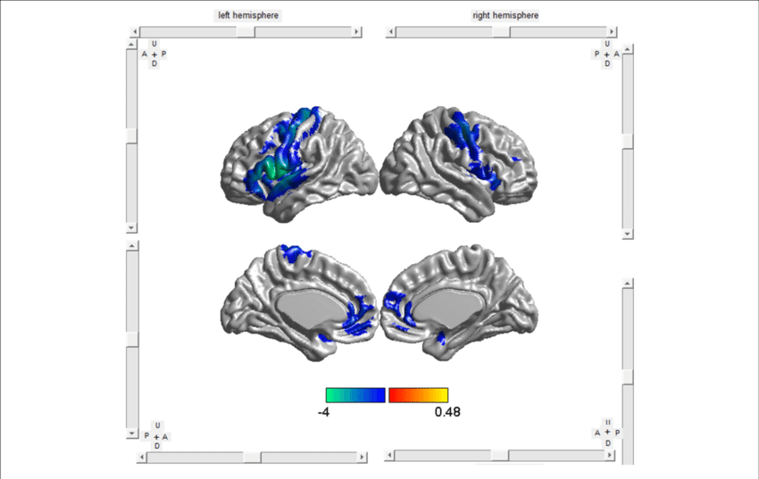 0 - Brain Clipart (850x537), Png Download