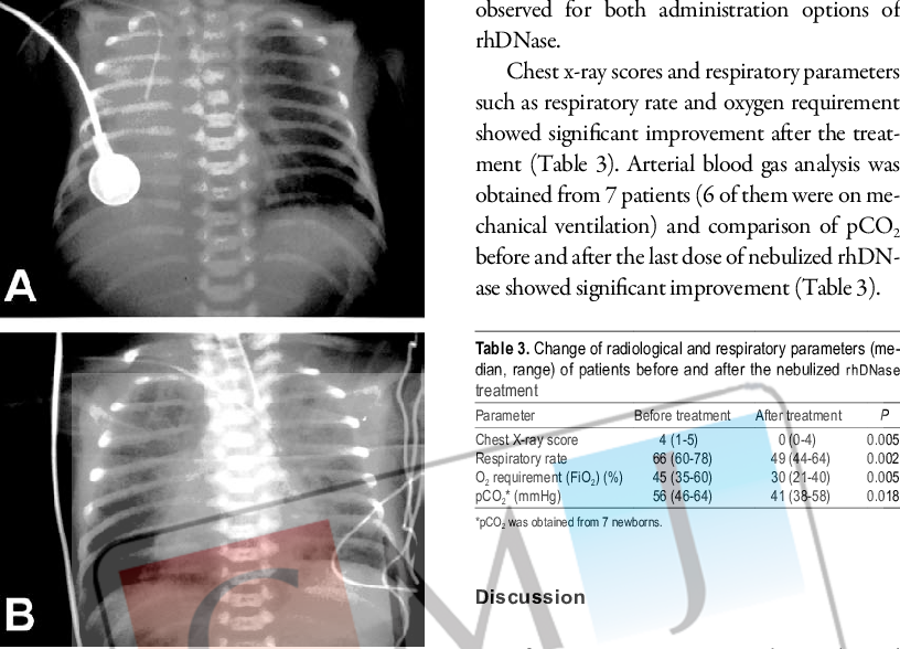 Localization Of Percutaneous Central Venous Catheter - Medical Imaging Clipart (816x588), Png Download