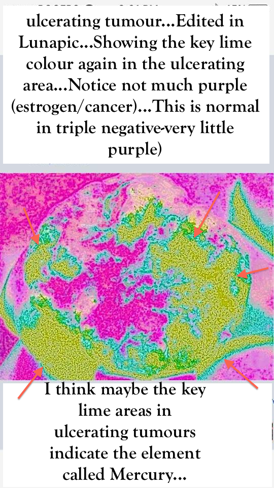 Triple- - Sterling College Clipart (540x960), Png Download