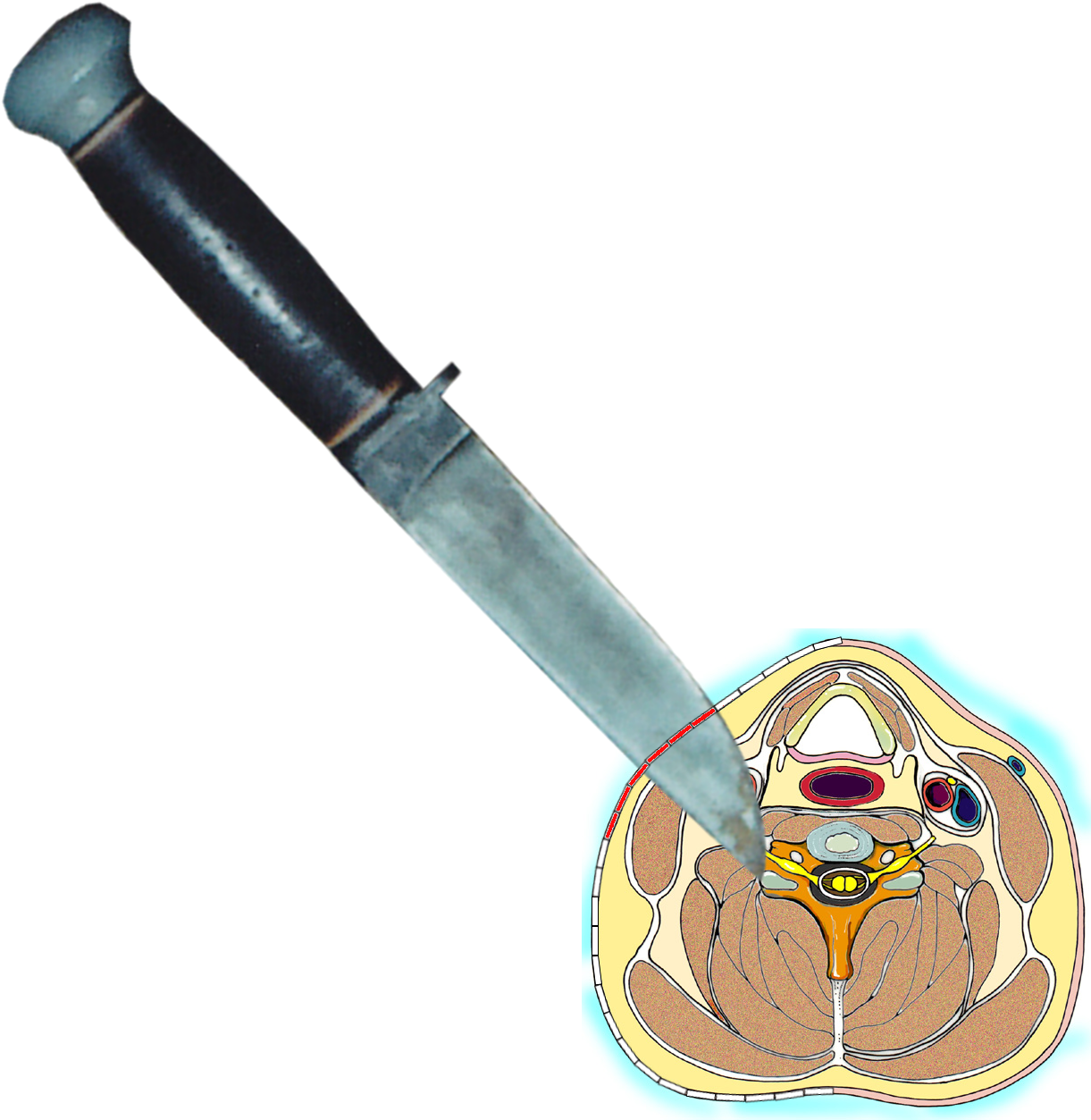 In These Cases, The Knife Hits The Vertebrae After - Cross Section Of The Neck Clipart (1236x1264), Png Download