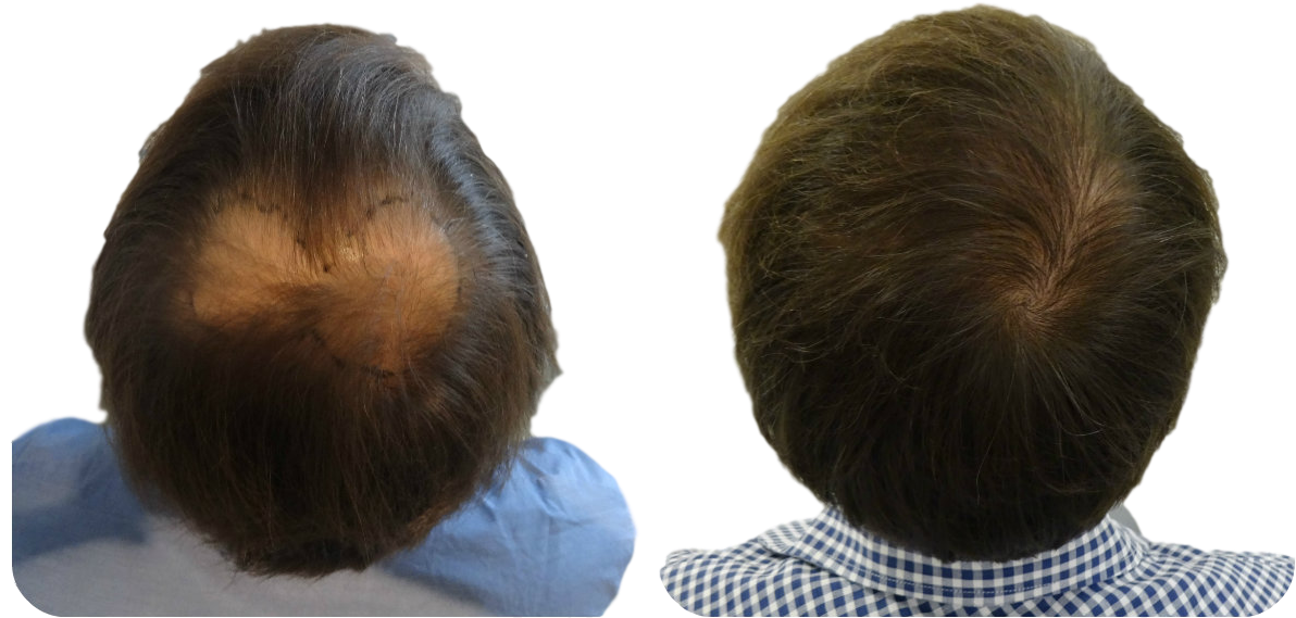 Free Online Consultation - Child Clipart (1200x600), Png Download