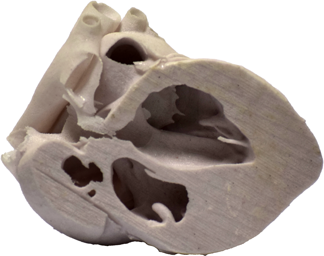 3d Printed Heart Cross Section - Skull Clipart (1080x854), Png Download