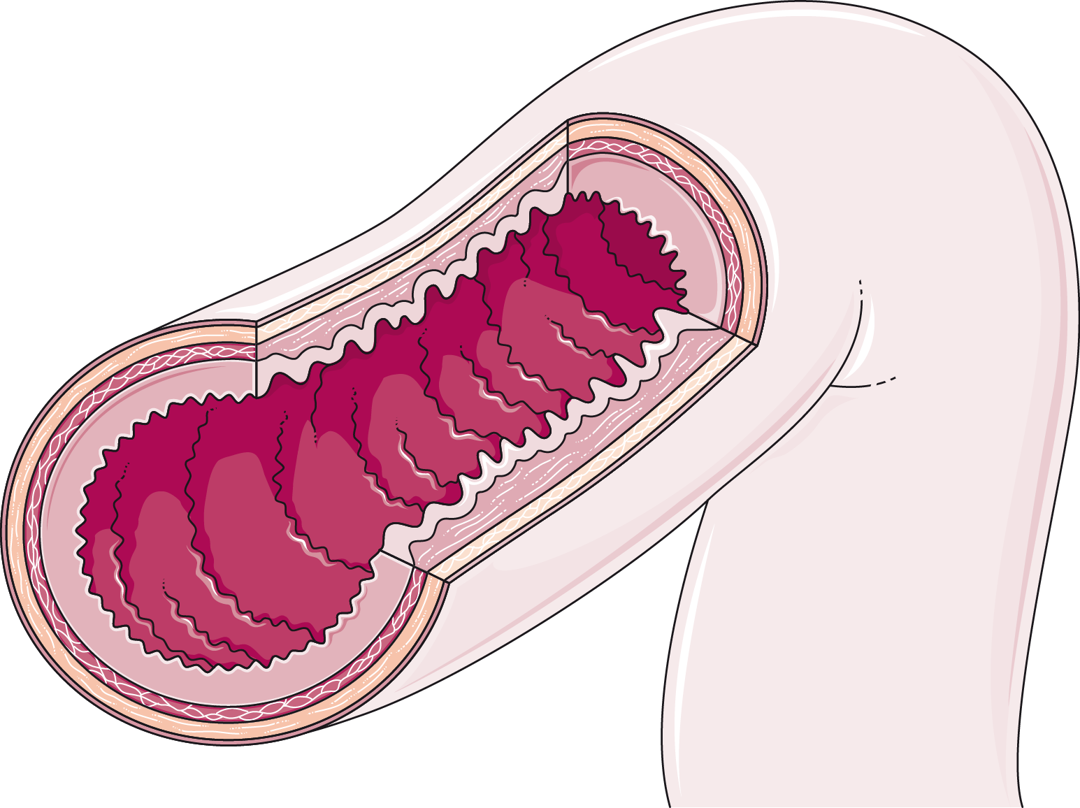 Download The Image - Oxalobacter Formigenes Clipart (1545x1156), Png Download