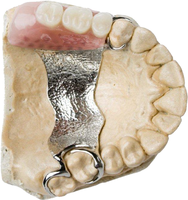 Complete & Partial Dentures, Dentures - Dental Prosthesis Clipart (661x714), Png Download