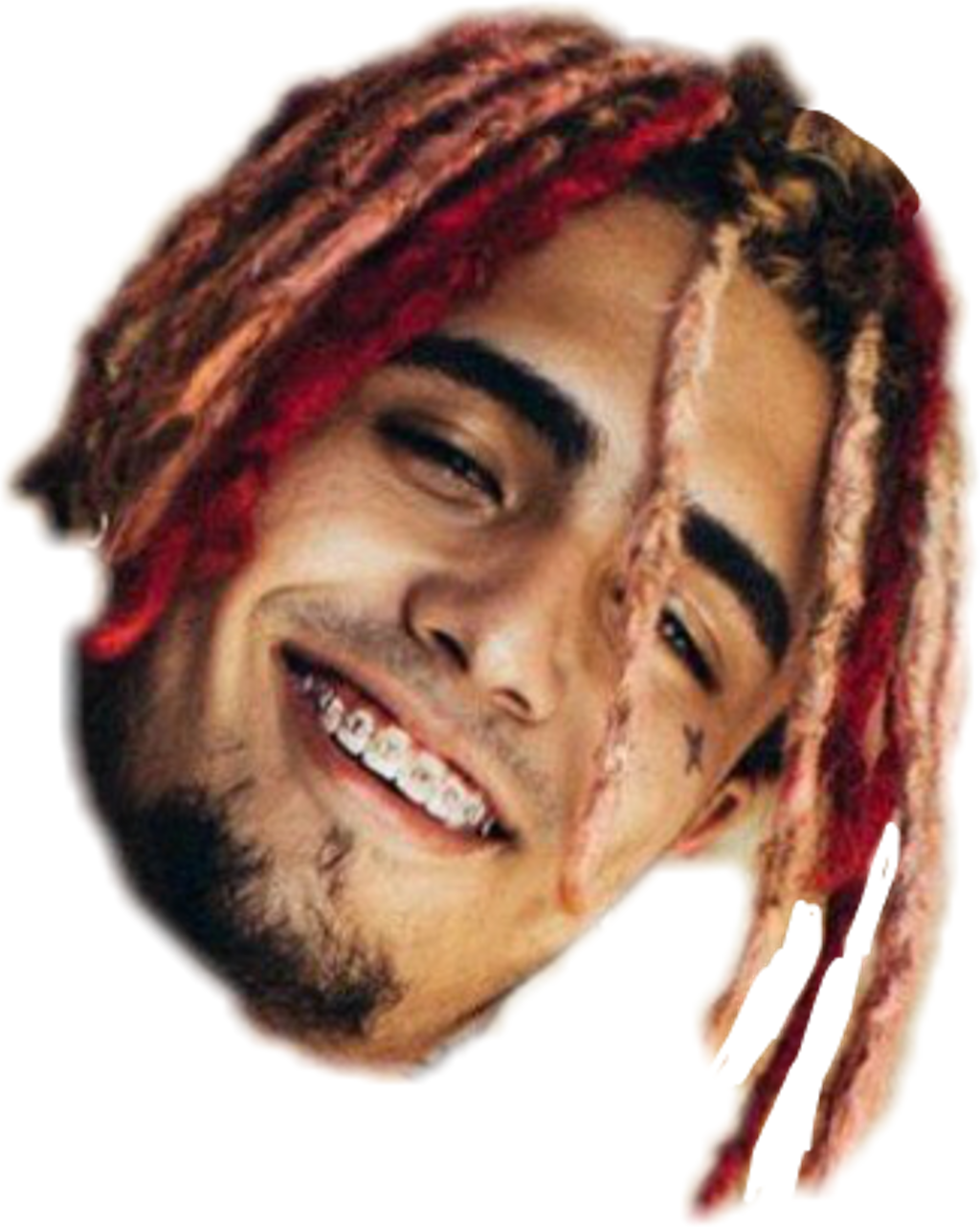 Report Abuse - Does Lil Pump Have Braces Clipart (1024x1282), Png Download