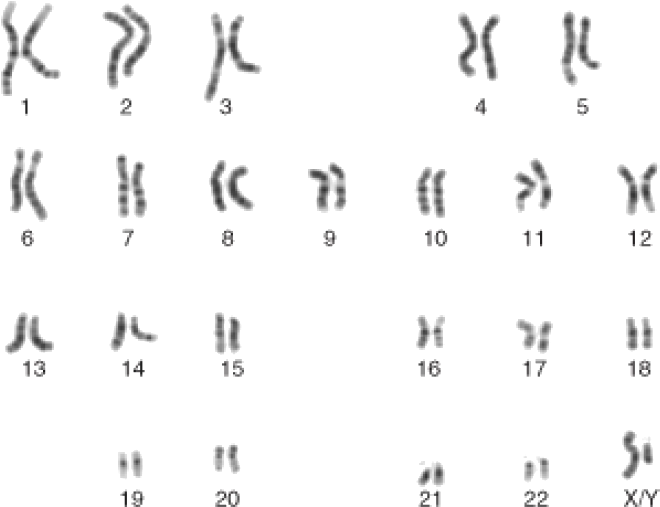 The 24 Human Chromosomes - Male Karyotype Clipart (712x542), Png Download