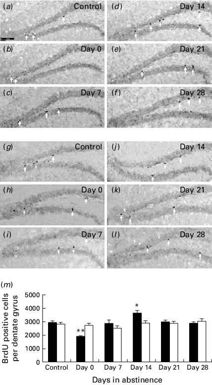 Effects Of Aqp4 Knockout On Cell Proliferation In Mouse - Colorfulness Clipart (428x776), Png Download