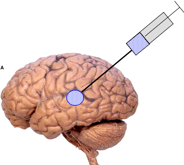 Brain2 - Nbme 15 Brain Clipart (606x543), Png Download