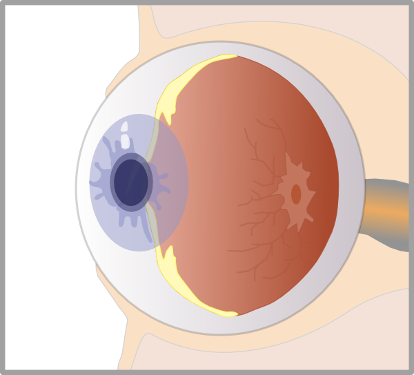 Small - Eye Diagram No Background Clipart (600x543), Png Download