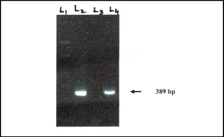 Nested Pcr Of 16s Rrna Of E - Granite Clipart (730x446), Png Download