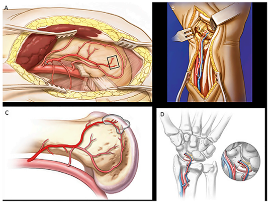 J Bone & Joint Surg - Illustration Clipart (800x400), Png Download