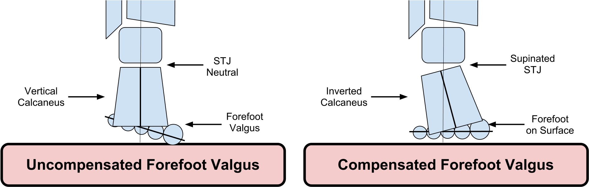 Forefoot Supinatus Clipart (1969x634), Png Download