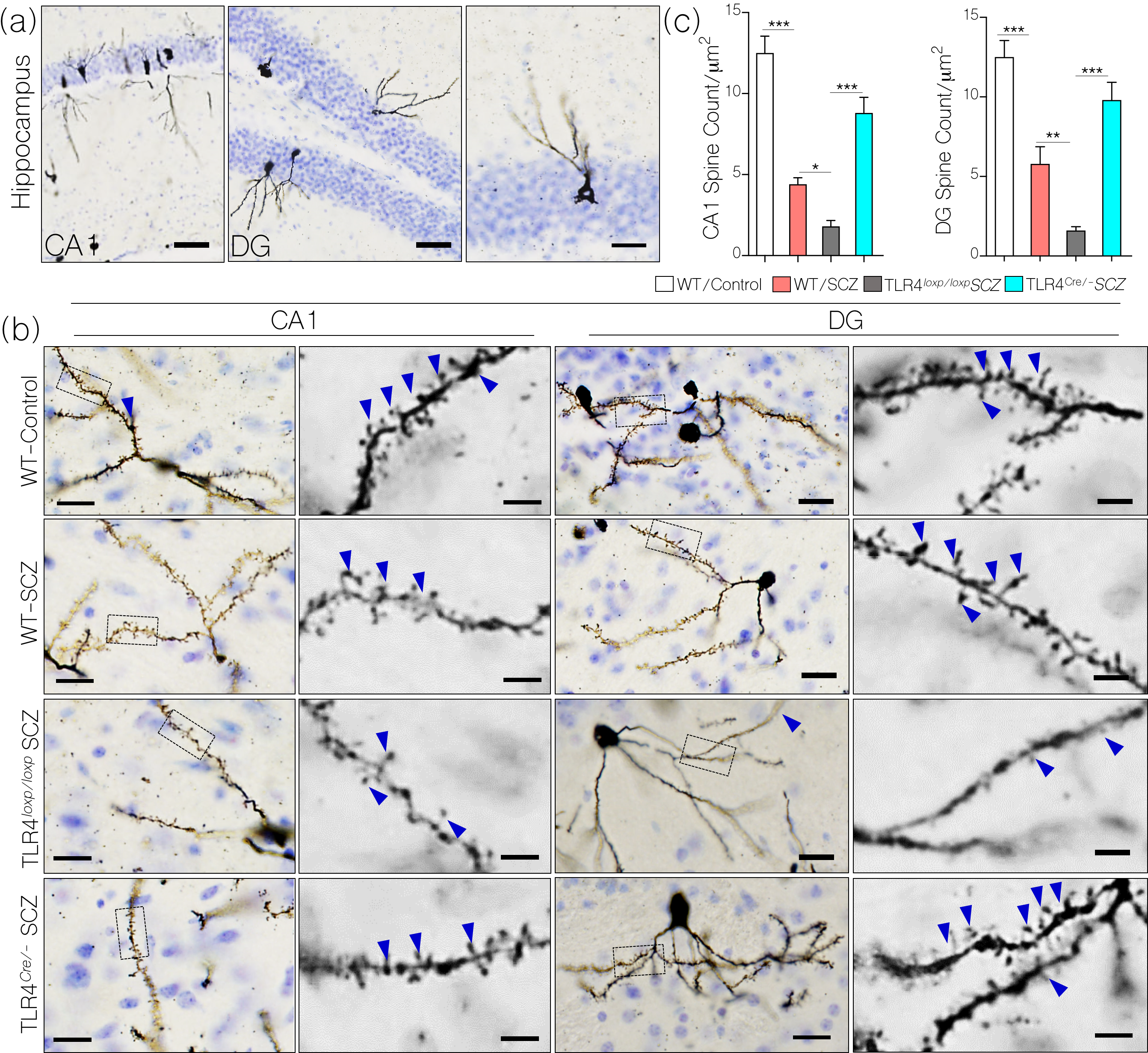 Neural Camkiiα Expression In A Mouse Model Of Nmdar - Graphics Clipart (2733x2561), Png Download