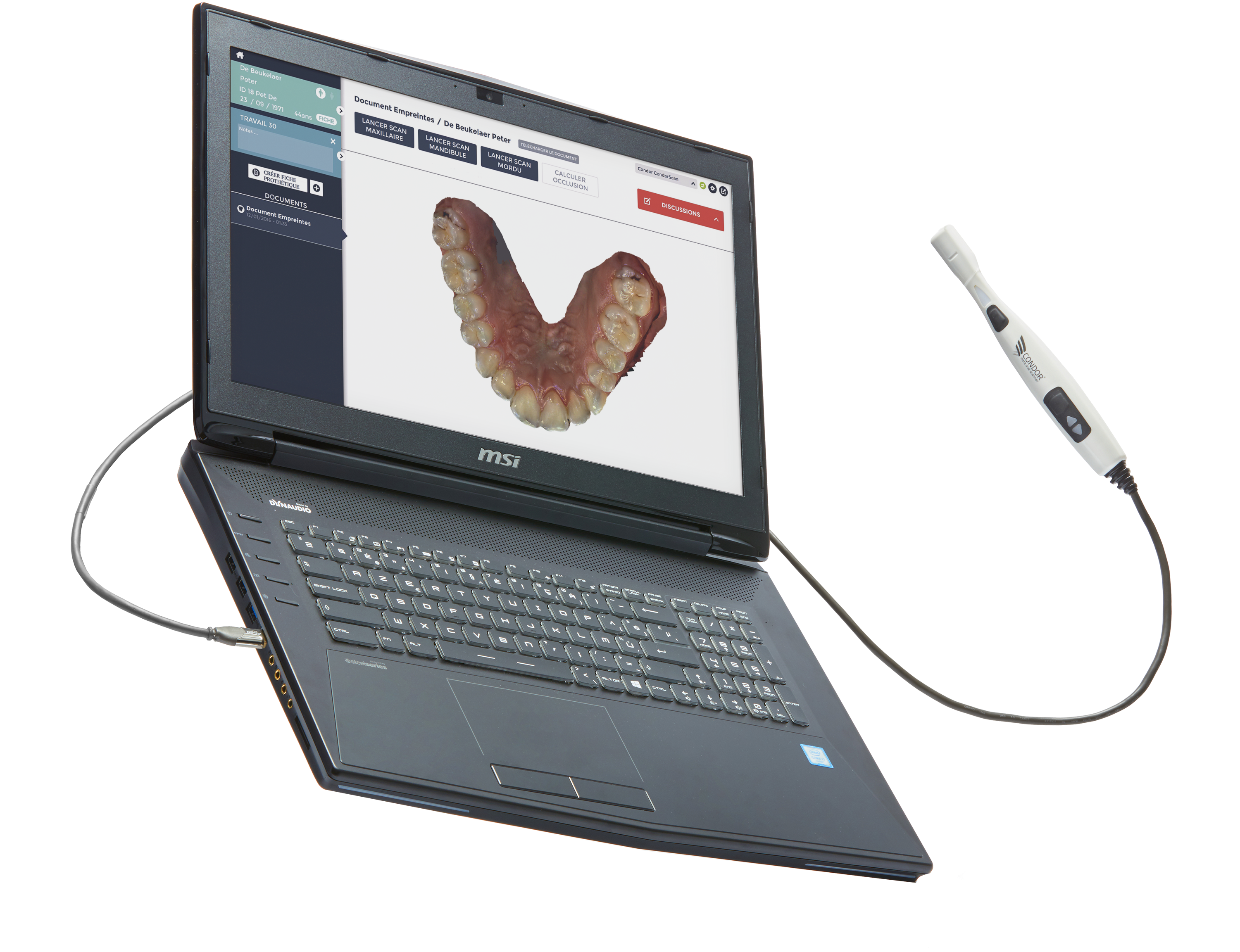 Hyper Realistic Colors - Oral Scanner Clipart (3000x2430), Png Download