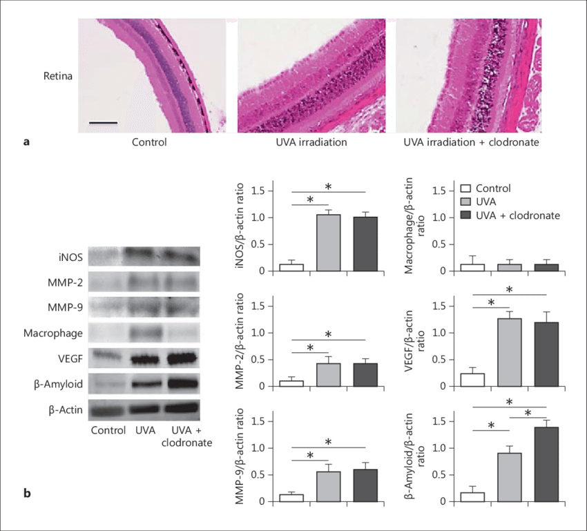 Long-term Ultraviolet A Eye Irradiation Induced Retinal - Architecture Clipart (850x769), Png Download