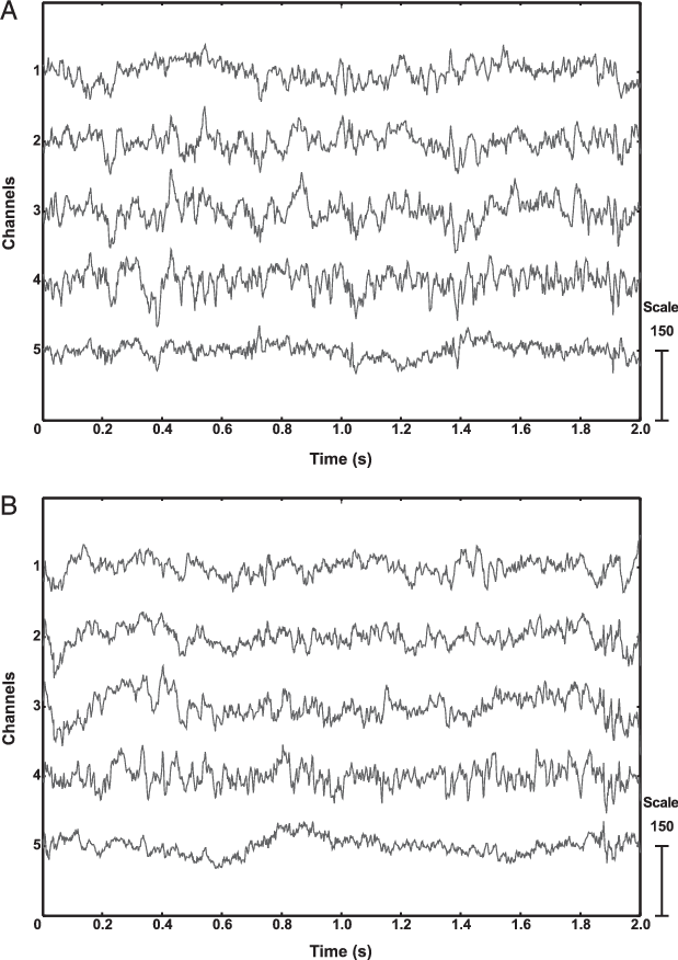 Eeg Record From The Flying And Resting Pigeon (b) That - Handwriting Clipart (619x876), Png Download