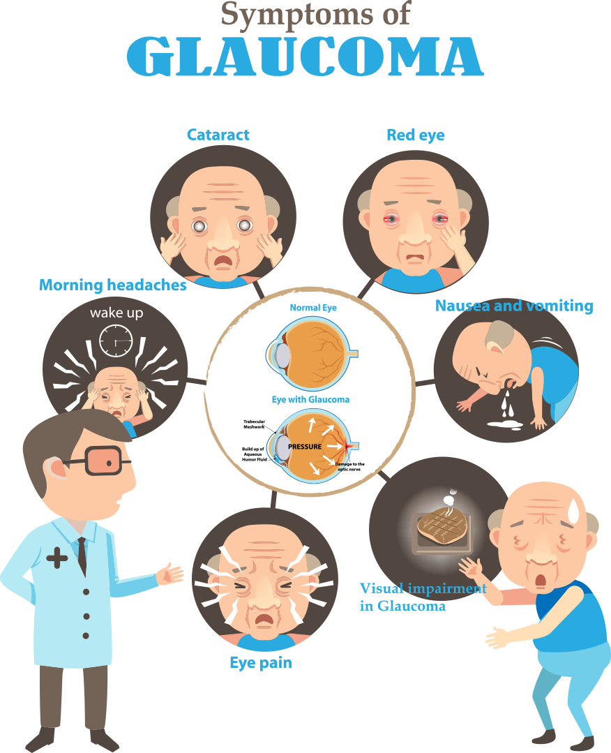 Eyeball Clipart Eye Strain - Glaucoma Symptoms - Png Download (876x1079), Png Download