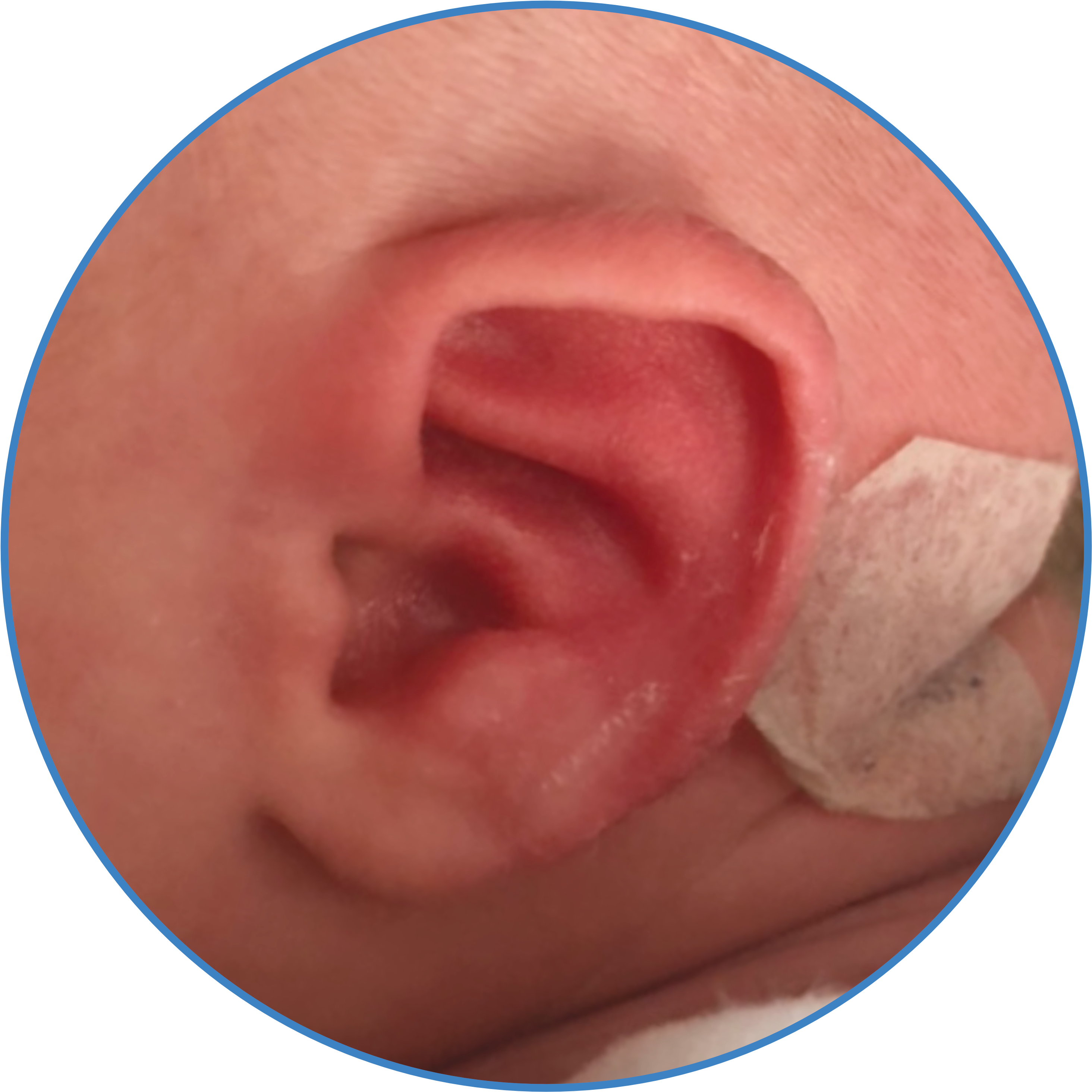 Baby Photo With Ear Buddies - Meat Clipart (2929x2929), Png Download