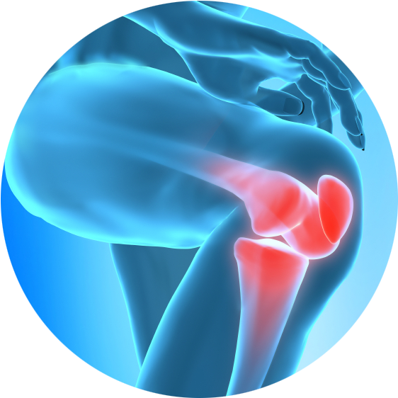 Chronic Joint Pain Slowing You Down Learn How Regenerative - Knee Pain In Png Clipart (562x562), Png Download