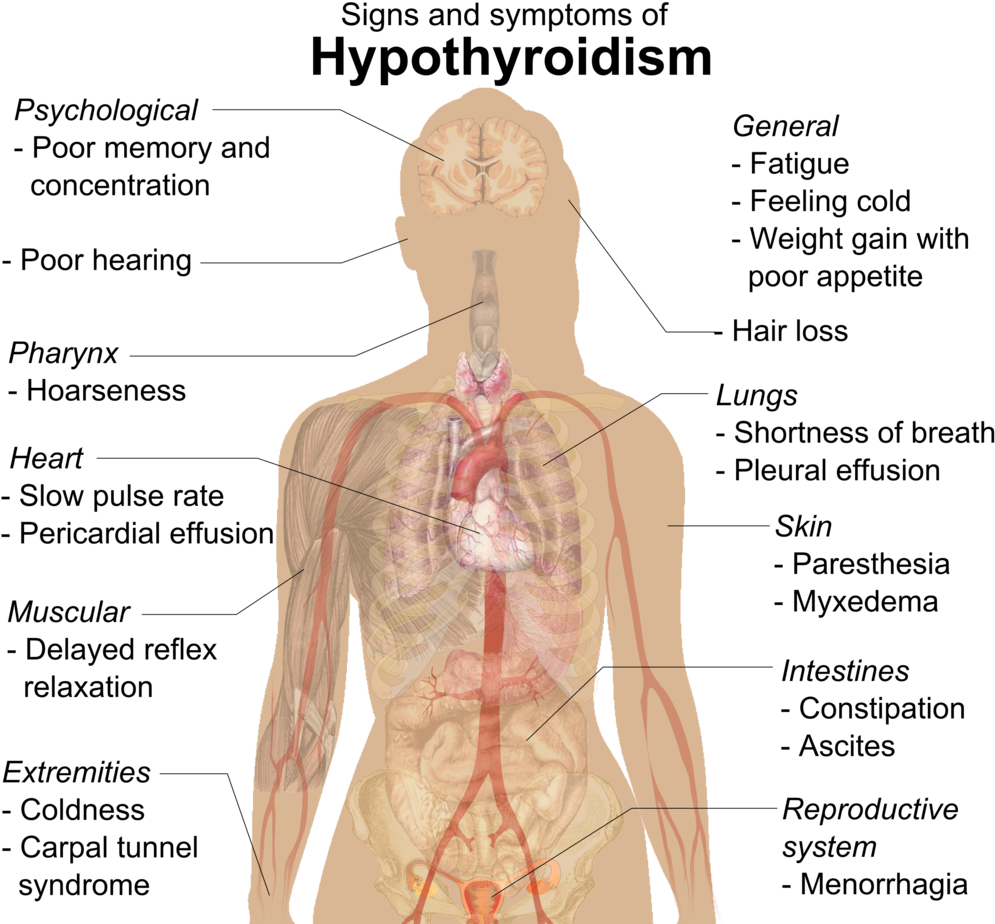 In Fact, If You Go To Your Psychiatrist Or Family Doctor - Differences Between Hypothyroidism And Hyperthyroidism Clipart (1024x927), Png Download