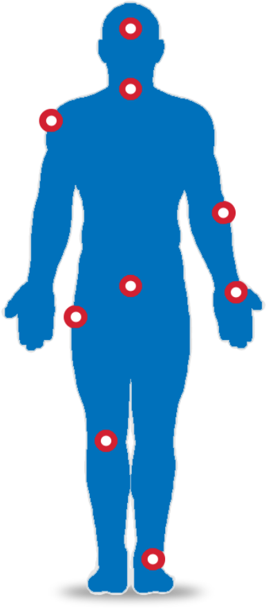 Areas Of Treatment - Illustration Clipart (800x923), Png Download