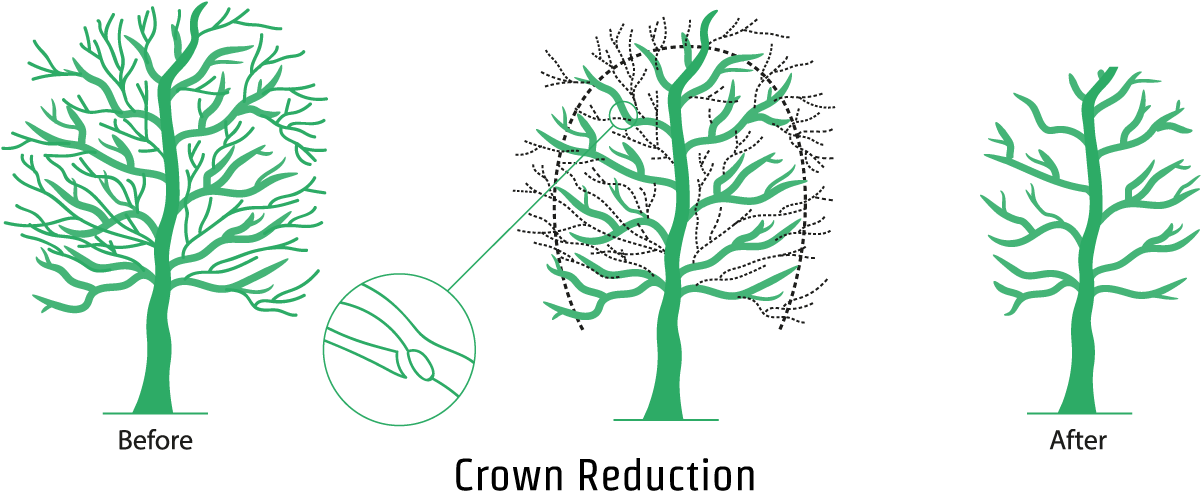 An Illustration Showing The Crown Reduction Process Clipart (1200x646), Png Download