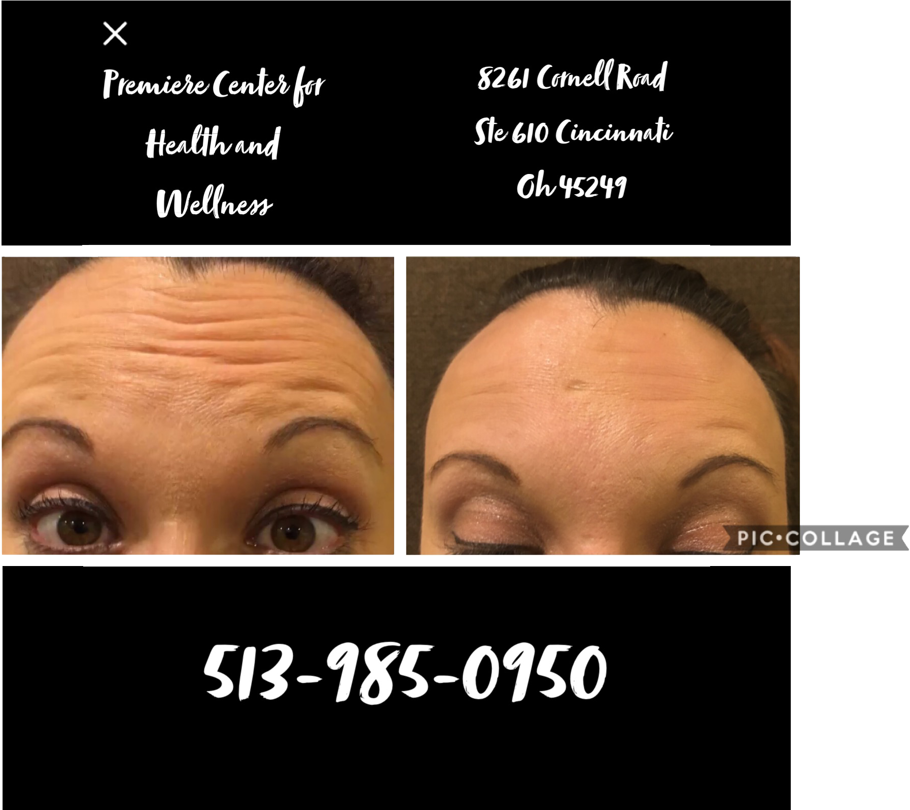 Premierecenters Botox Clipart (2400x1596), Png Download