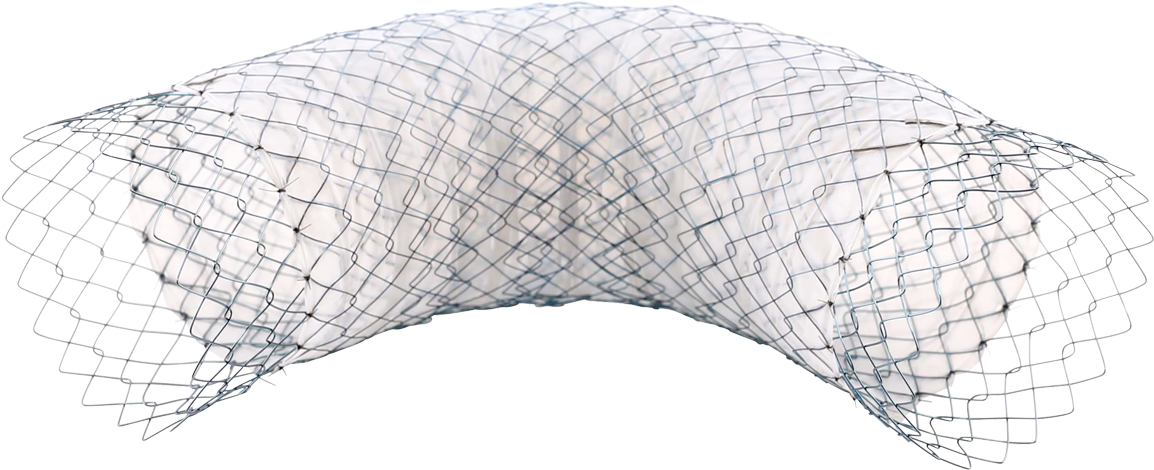 A - Partially Covered Self Expandable Metal Stents Clipart (1280x720), Png Download