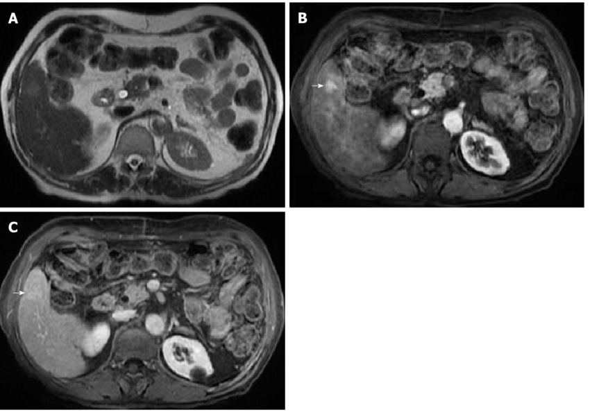 Fat Person Png - Radiology Clipart (850x601), Png Download