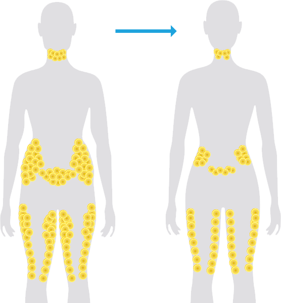 Coolsculpting® Fat Reduction - Unique Beauty And Laser Clinic Clipart (556x599), Png Download