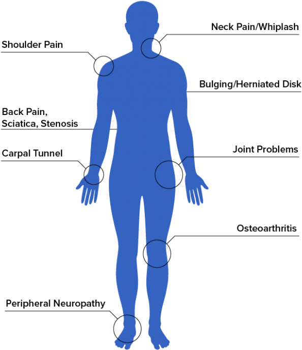 Symptoms We Treat For Pain Relief - Standing Clipart (700x700), Png Download