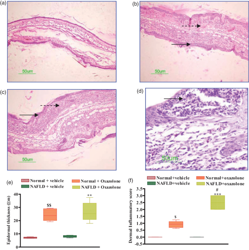 Effect Of Oxazolone On Ear Histopathology In Normal - Mouse Ear Inflammation Histo Clipart (850x852), Png Download