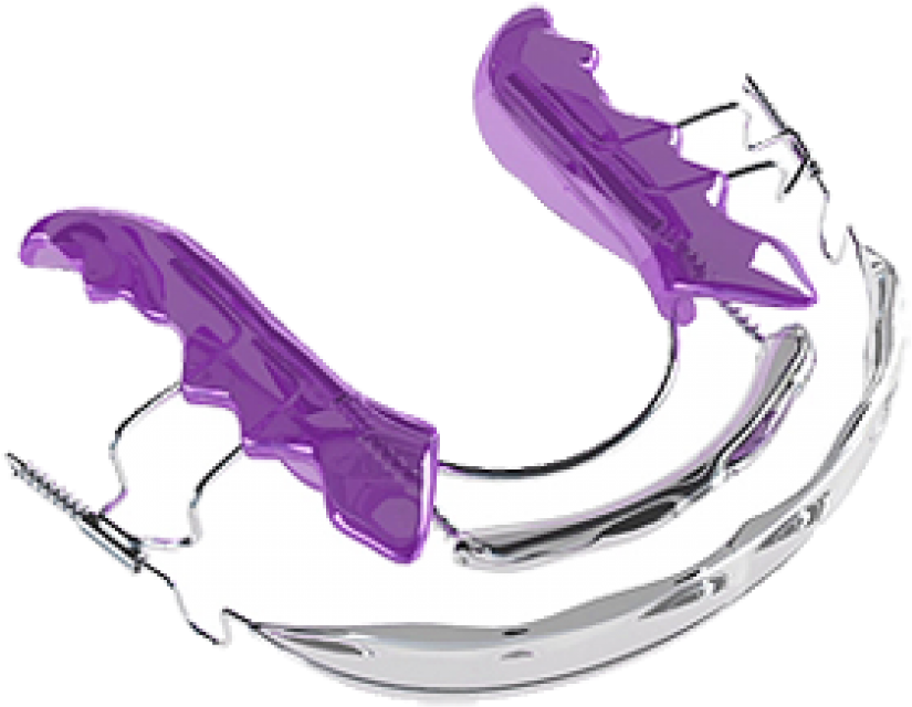 Appliances - Inman Aligner Spange Clipart (970x700), Png Download