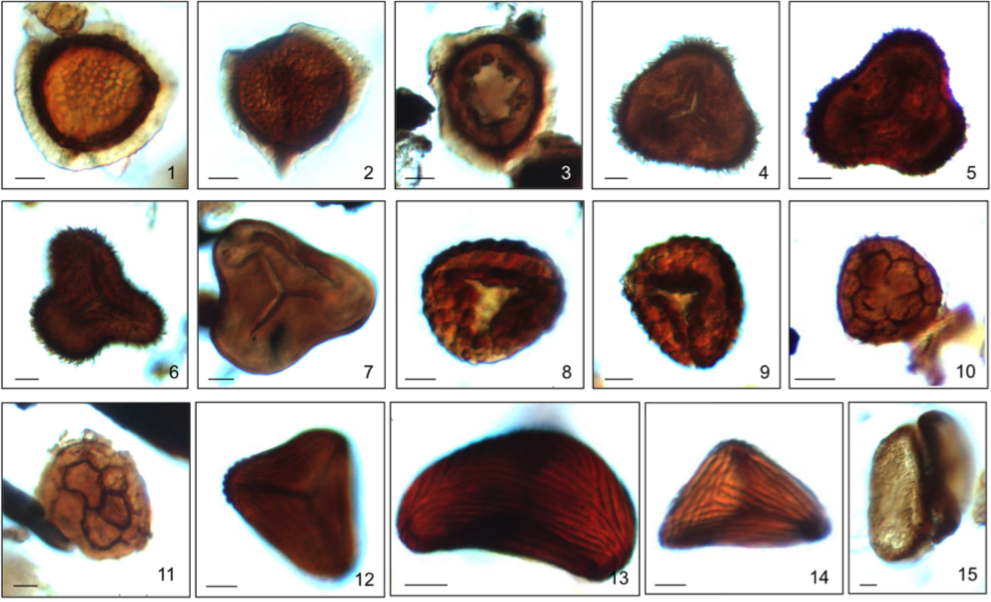 Pilosisporites Trichopapillus, - Thread Clipart (991x602), Png Download