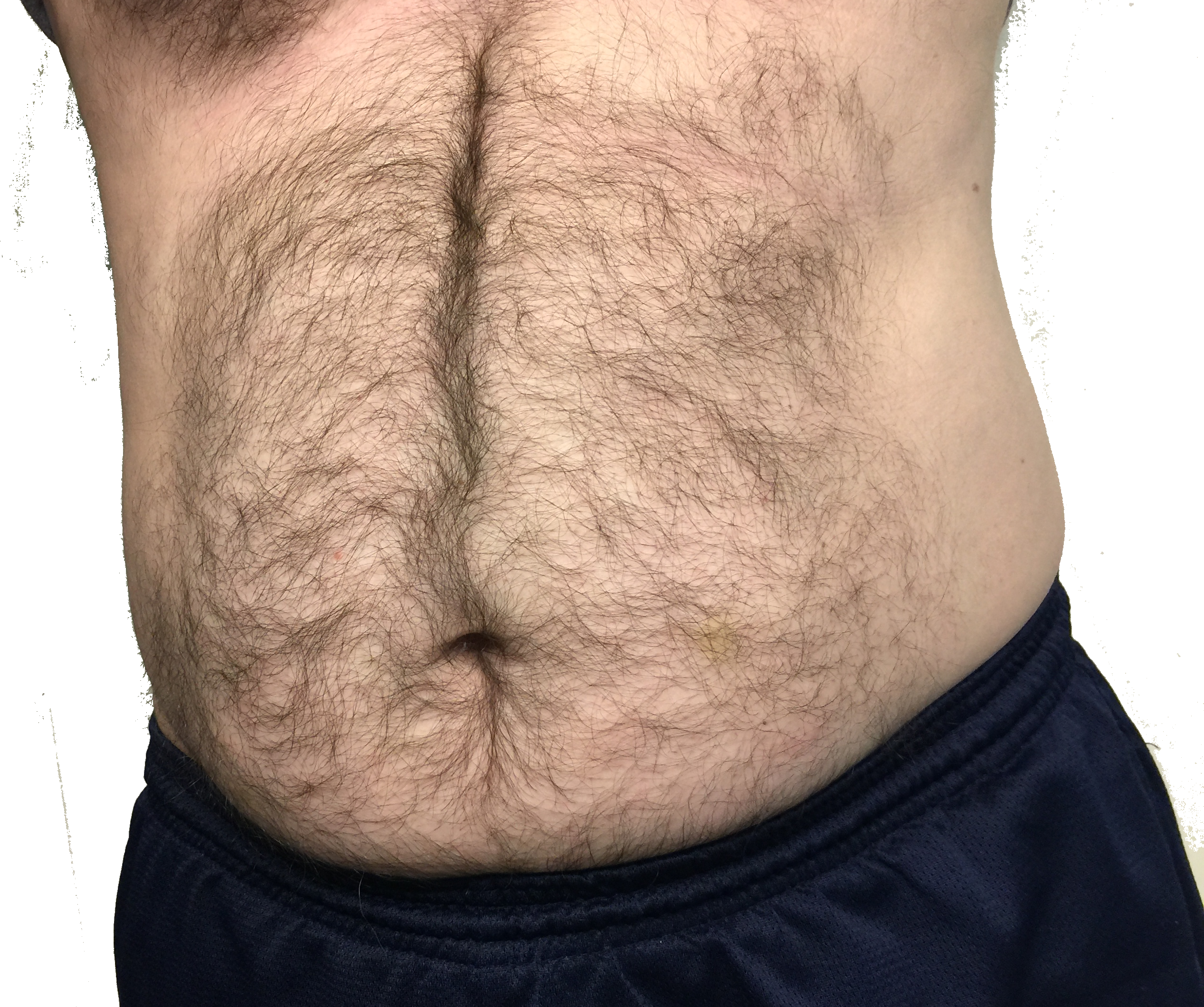 Fat Man Belly Png Clipart (2535x2121), Png Download