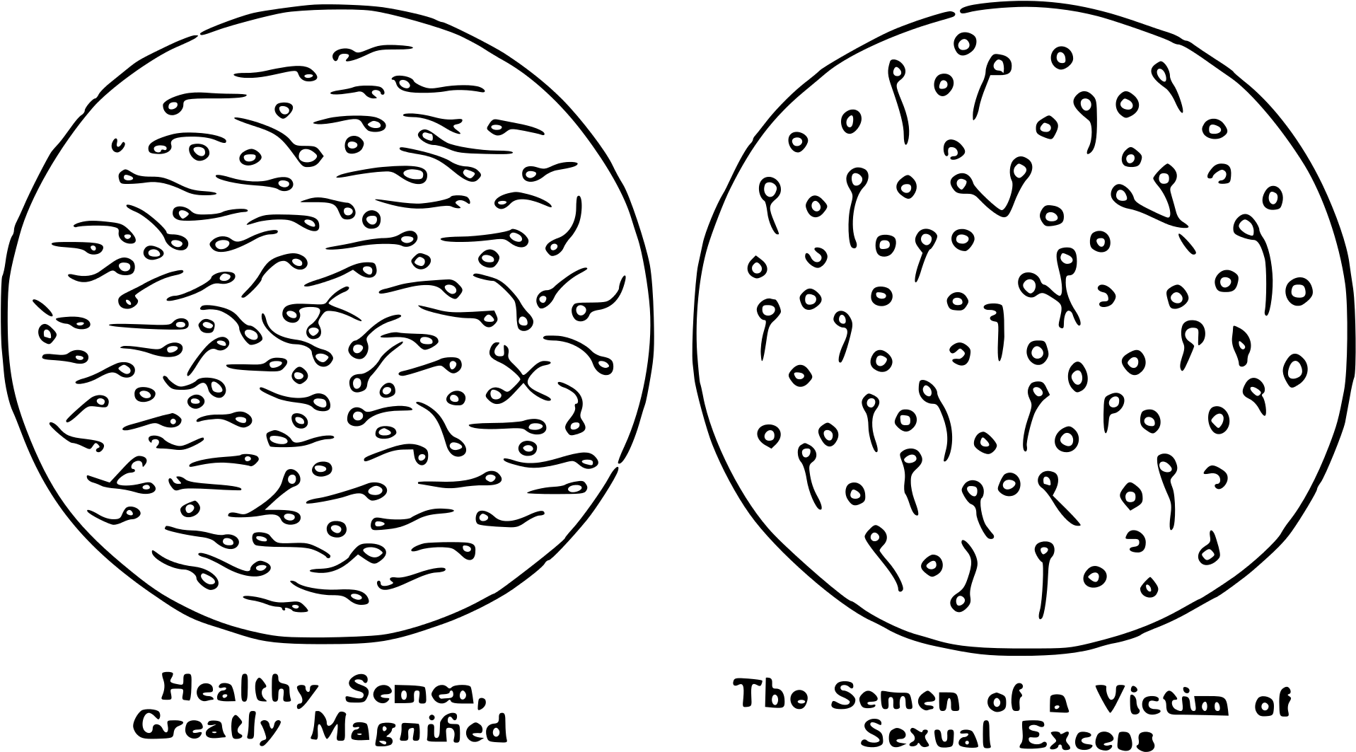 Open - Masturbation Is Healthy Clipart (2000x1142), Png Download