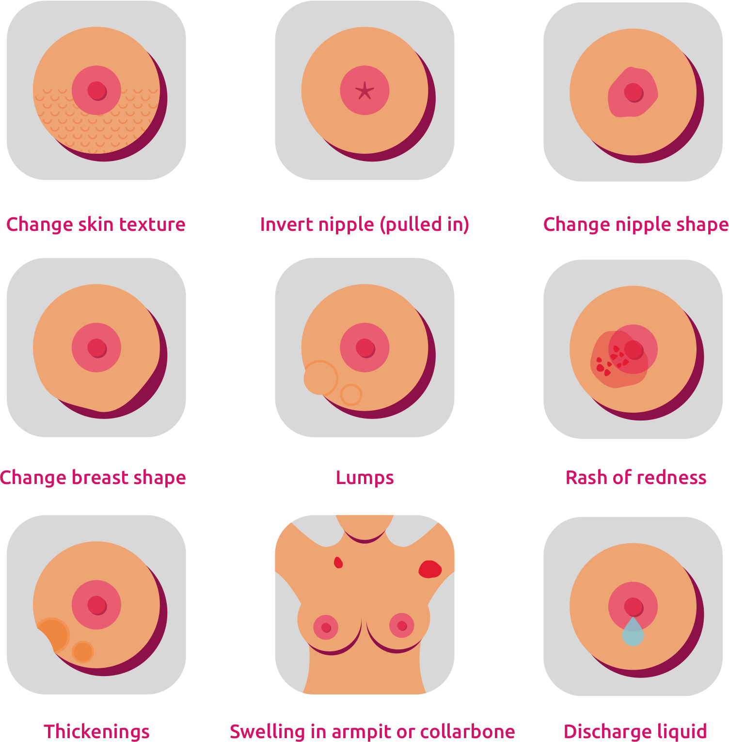 Nipple Discharge Or An Enlarged Underarm Lymph Node - Lumpy Nipple Clipart (1504x1530), Png Download