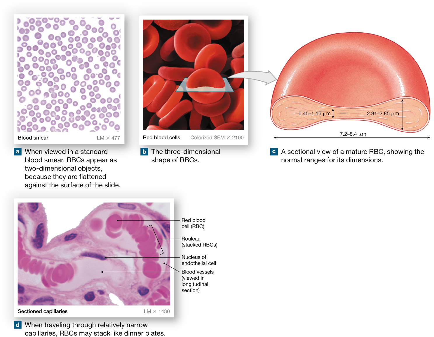 Red Blood Cells, Formed By Erythropoiesis, Contain - Anatomy Of Rbcs Clipart (1500x1174), Png Download