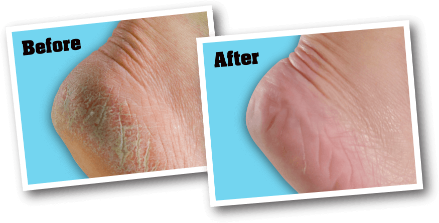 For Best Results - O'keeffe's For Healthy Feet Foot Cream Clipart (1000x500), Png Download