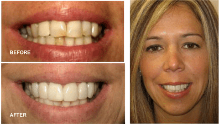 Free Png Download Dentist In Hicksville Png Images - Jaw Clipart (850x484), Png Download