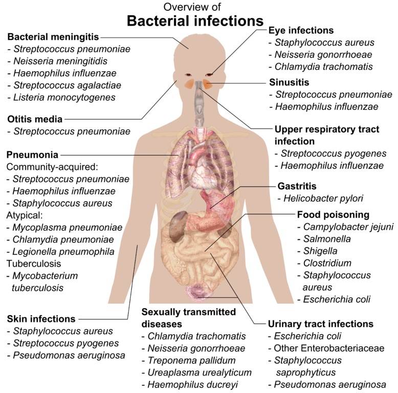 Bacterial Infections And Involved Species - Overview Of Bacterial Infections Clipart (778x768), Png Download