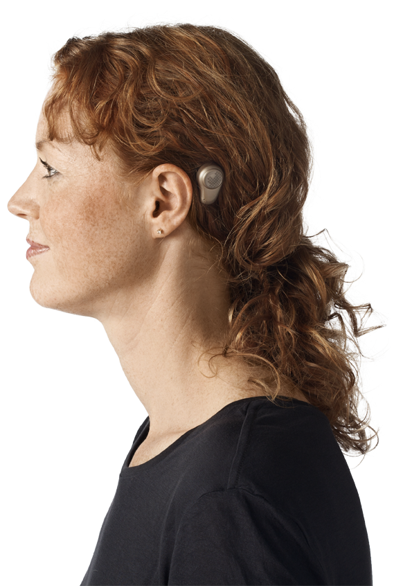 The Sound Processor From Oticon Medical Behind The - Bone Anchored Hearing Aid Nz Clipart (1000x903), Png Download