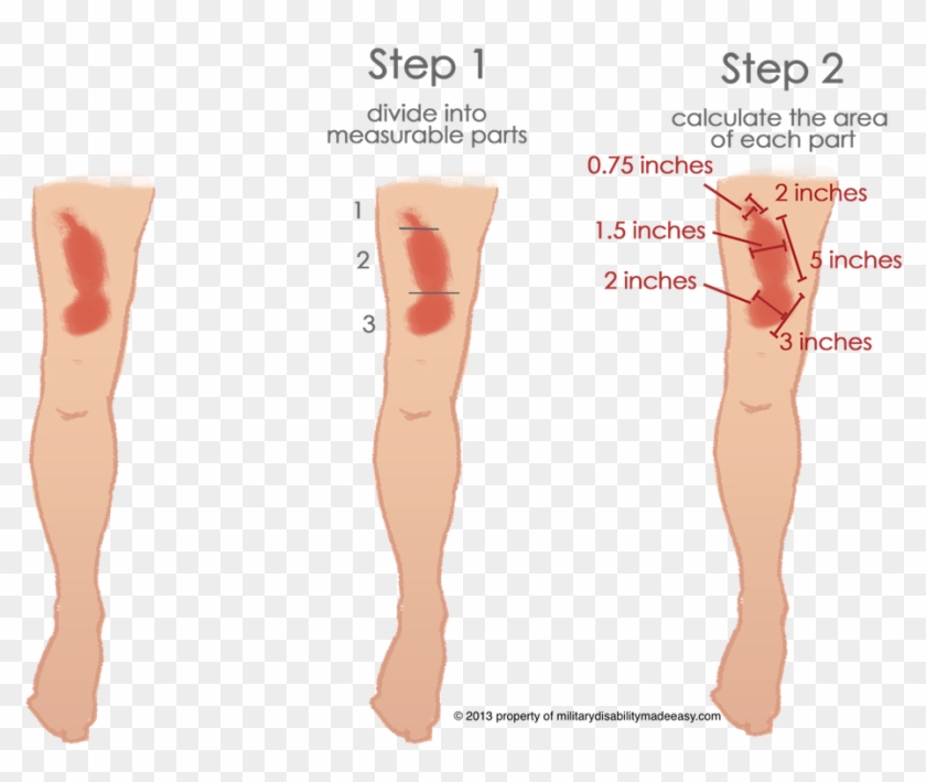 Scar Example - 3 Inch Scar Clipart
